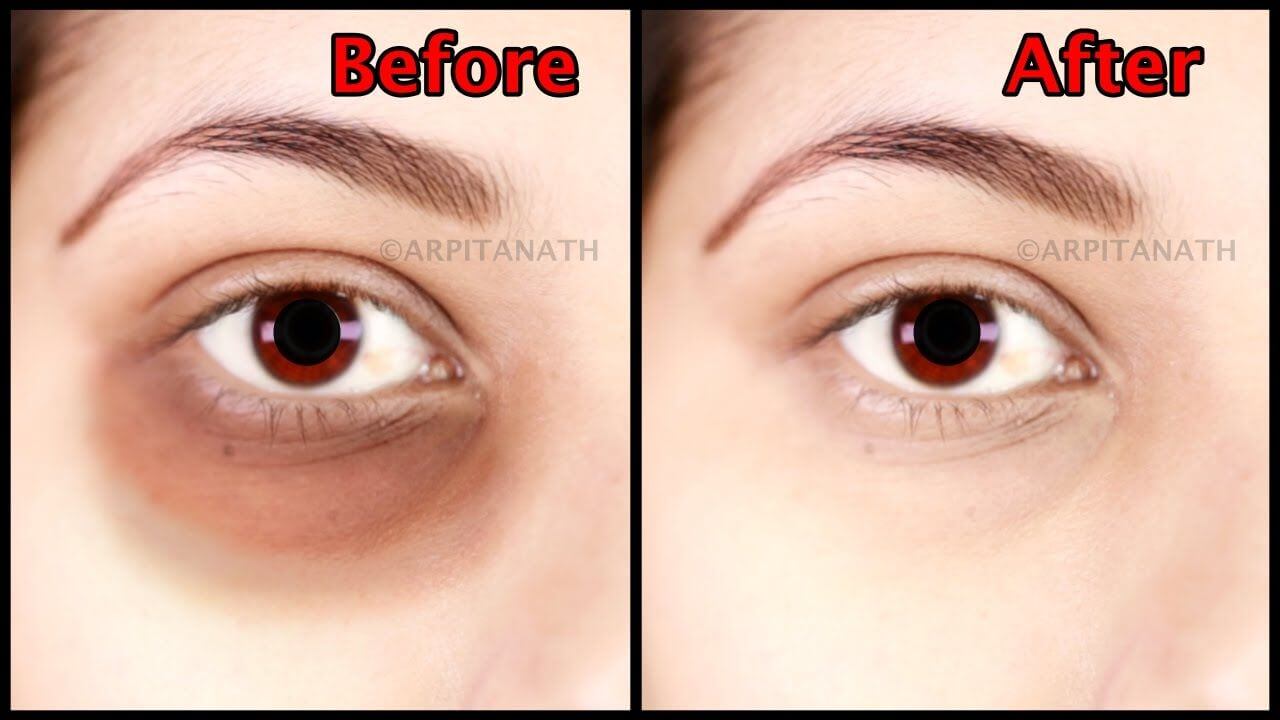 6 tips to say goodbye to eye bags (1)